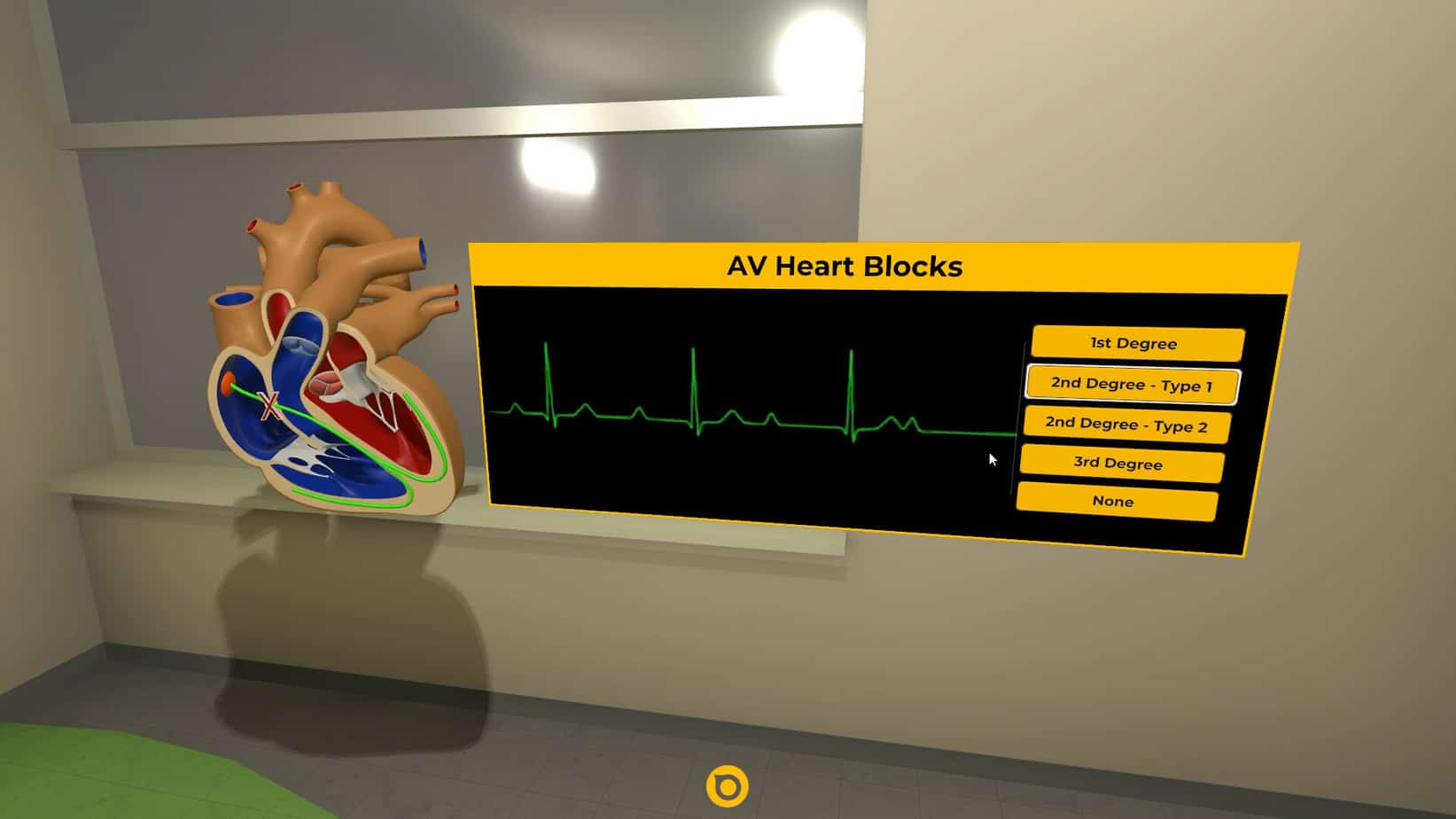 Heart Block Visualization - animated cardiac anatomy