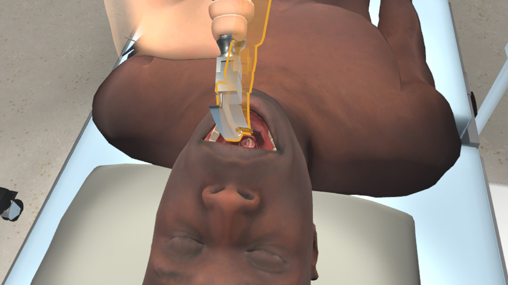 Endotracheal intubation VR medical simulation